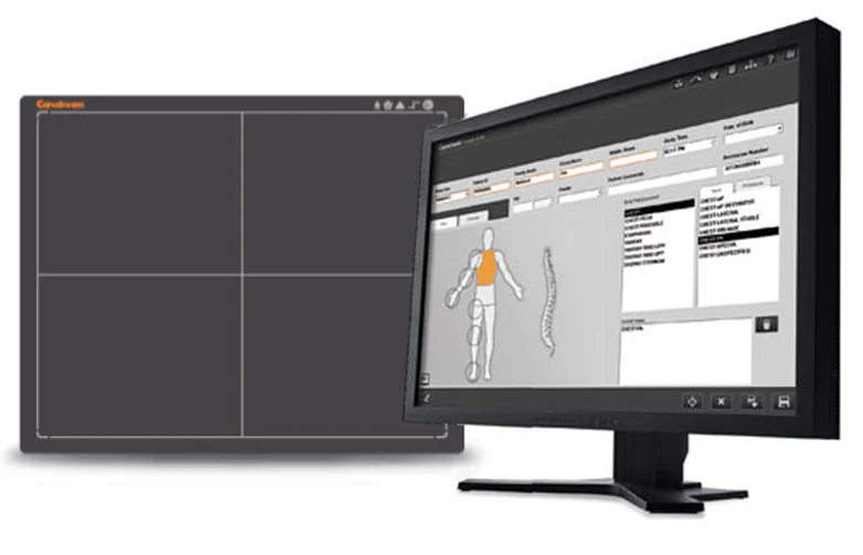 Панель-детектор Carestream Focus 35C