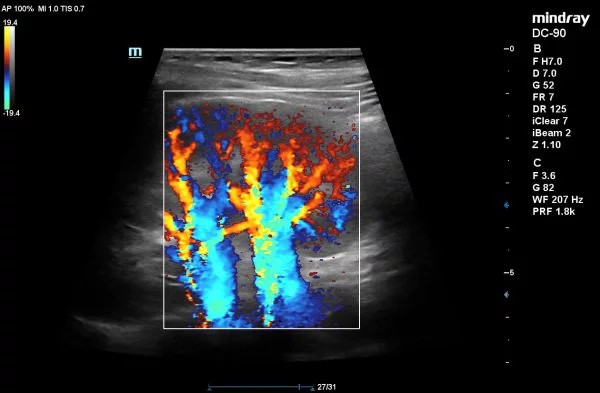 DC-90_X-13453564347734566