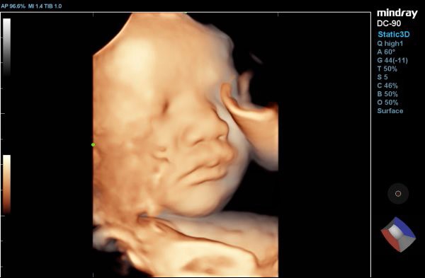 DC-90_X-231453454353243478789