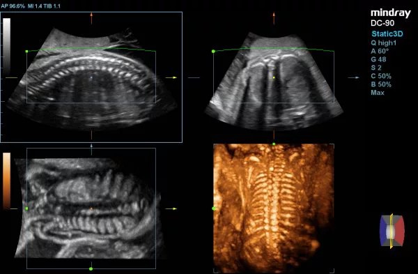 DC-90_X-24355476876555567