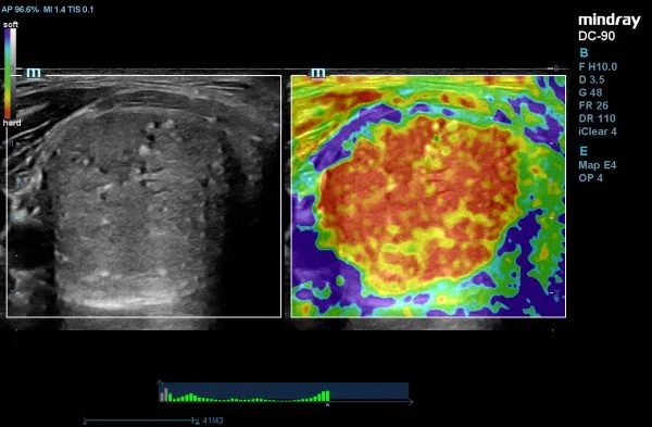 DC-90_X-432654352436234235854