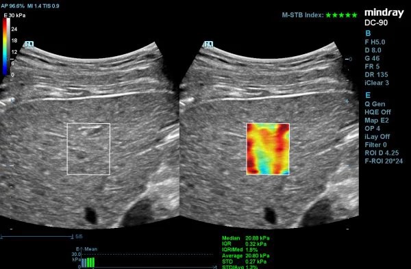 DC-90_X-51235152353462