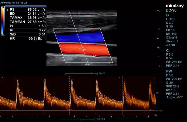 DC-90_X-54243575007897067