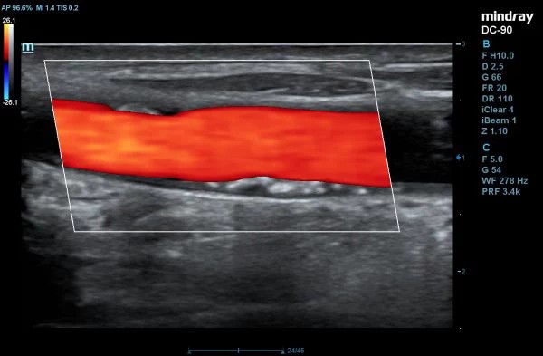 DC-90_X-675796788760908