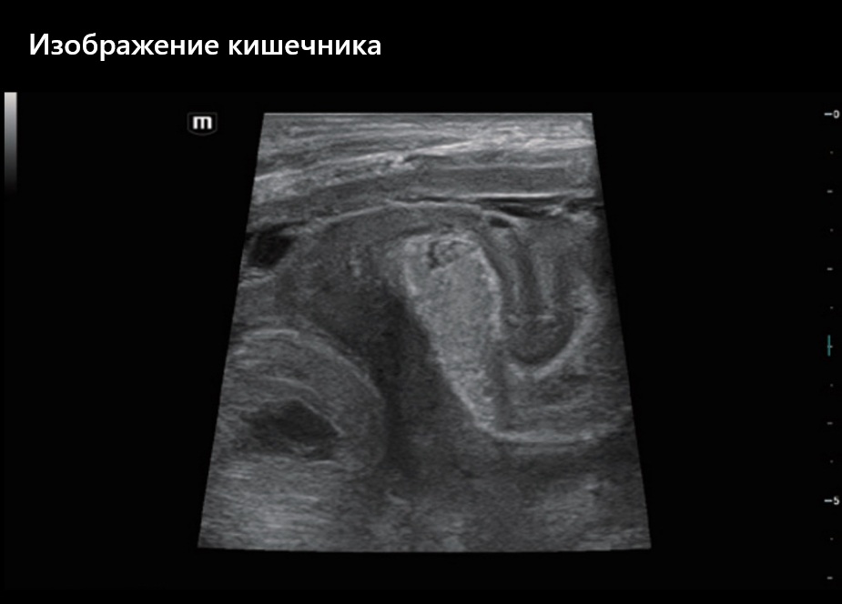 Изображение кишечника