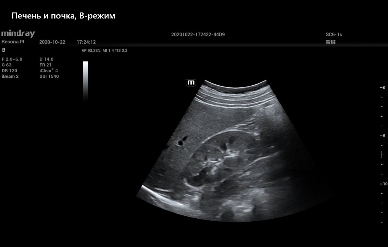 Печень и почка, В-режим