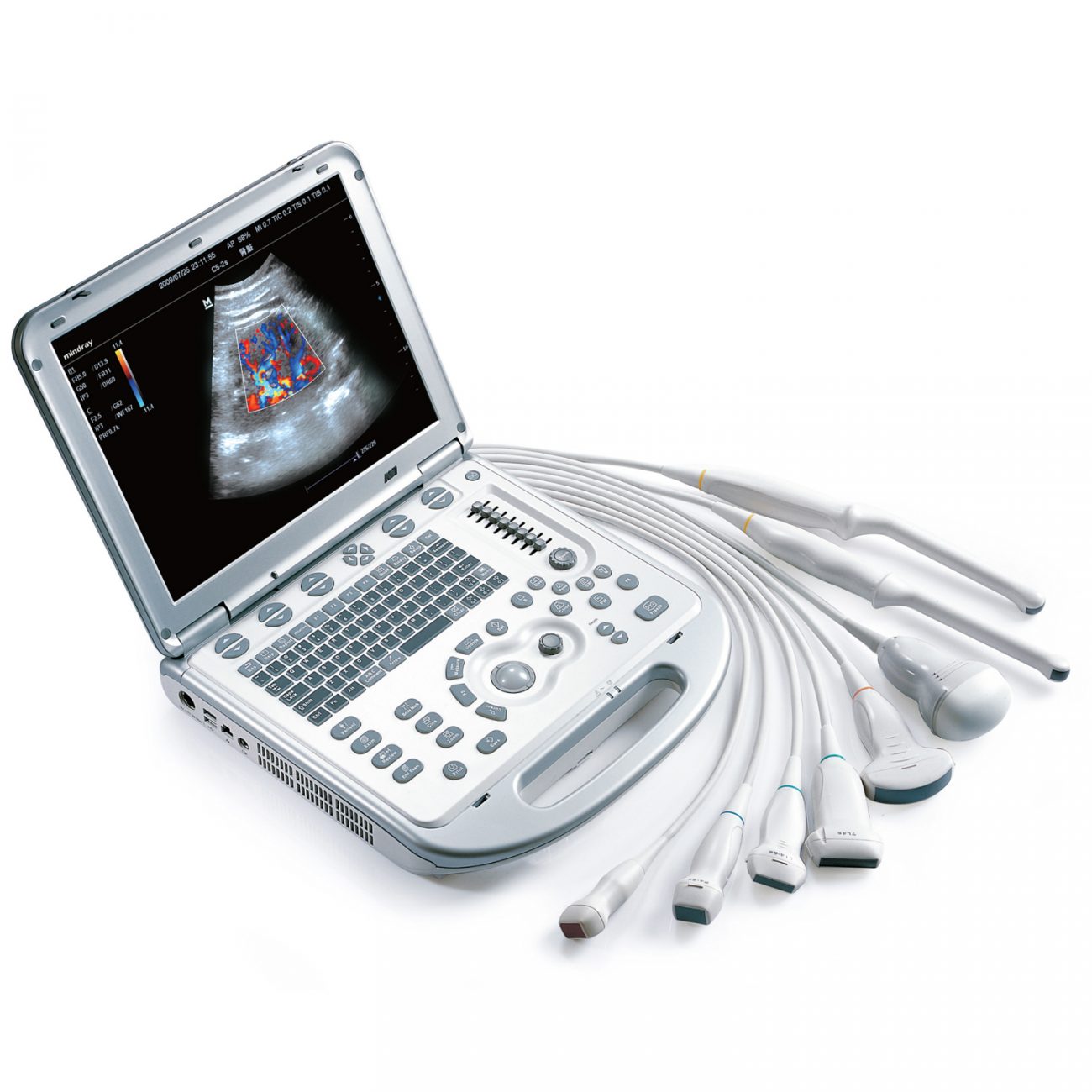 УЗИ аппарат Mindray M6 exp